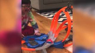 Arracher une dent qui branle... grâce à une voiture Hot Wheels!